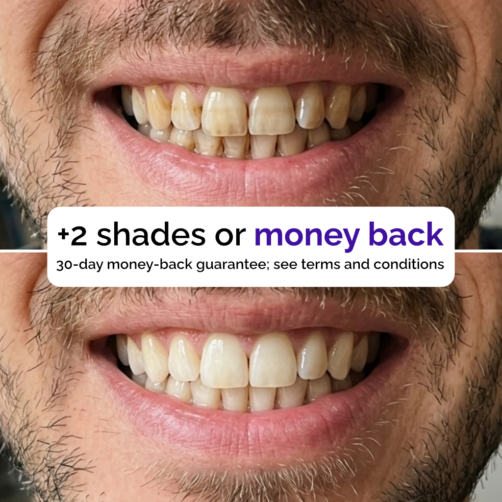 PAP+ Whitening Strips