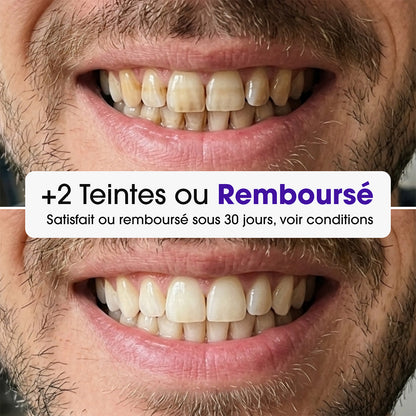 Bandes Blanchissantes PAP+